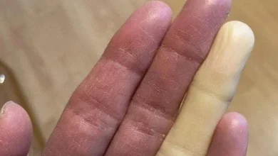 Photo of The Shocking Consequences of Sleeping With the…See more