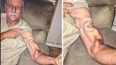 Photo of A Man Goes To Stretch And Ends Up Feeling A Sharp Pain In His Arm, It Was A Case That Shocked Everyone