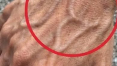 Photo of If you have visible veins, it means you are…