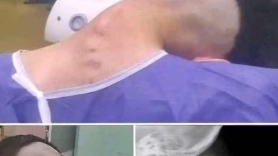 Photo of 7. Young Man Hospitalized Because He Dropped His Ca…See More