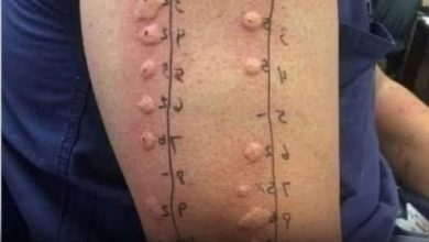 Photo of These are the consequences of sleeping with the wrong person, as the situation quickly spirals into emotional, physical, or even social complications. What begins as a seemingly harmless choice can unfold into long-term regrets, unexpected issues, and uncomfortable outcomes that many people never anticipate.