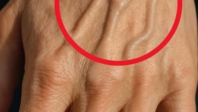 Photo of If you see someone with bulging veins, you must tell them these things