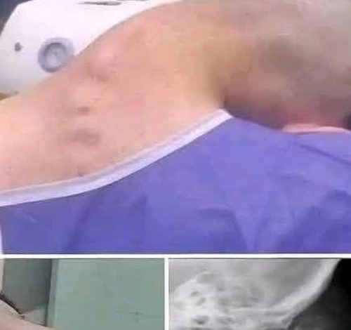 7. Young Man Hospitalized Because He Dropped His Ca…See More