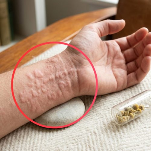 These Are Consequences of Sleeping With…