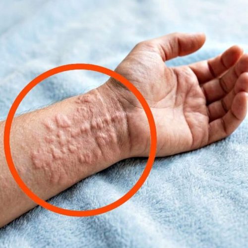 These Are Consequences of Sleeping With…