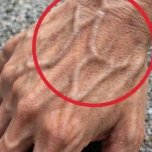 If you have visible veins, it means you are…