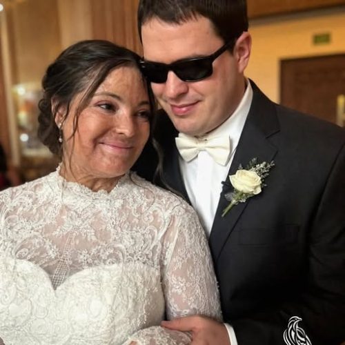 I Married a Blind Man So He’d Never See My Scars – On Our Wedding Night, He Said, ‘You Need to Know the Truth I’ve Been Hiding for 20 Years’