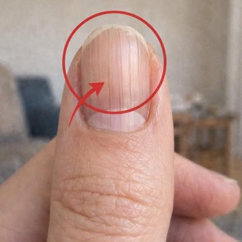 Surprising Secrets Your Fingernails Can Reveal About Your Health And Aging